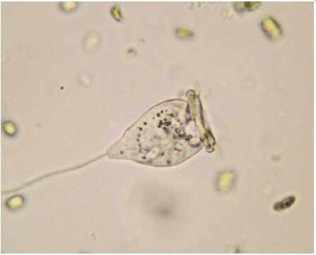 A Vorticella
